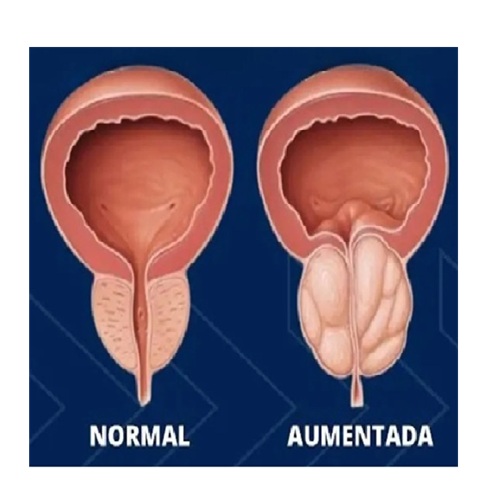 cuidados com a prostata